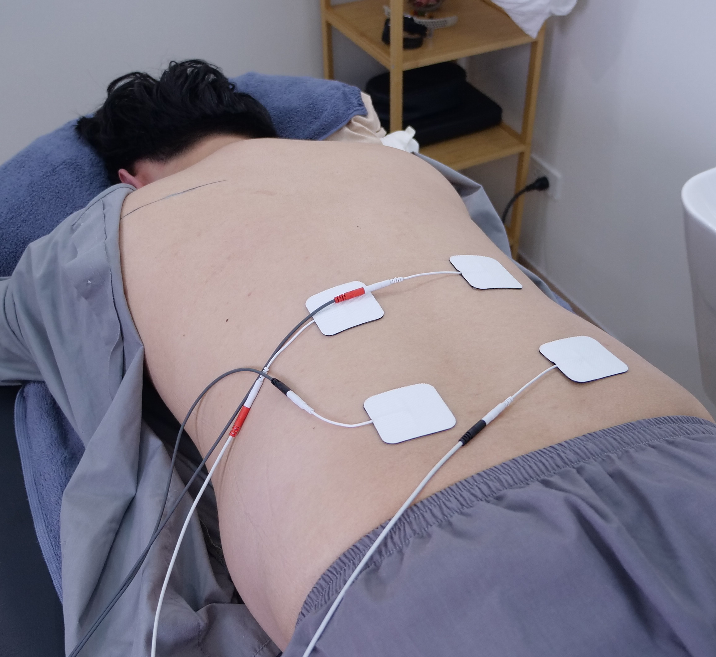 Electrical Stimulation